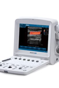 Ultrasound-Color-doppler